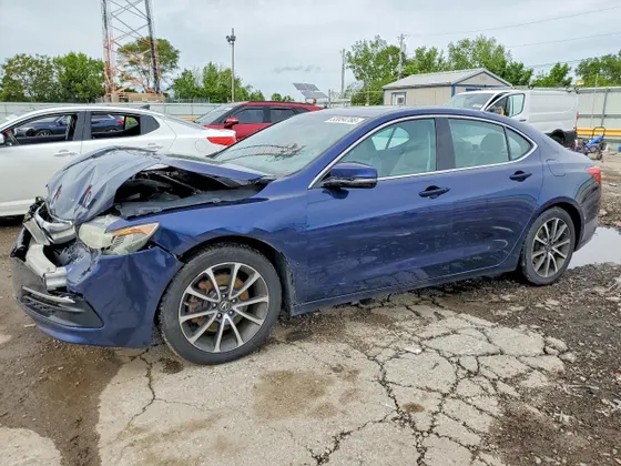 2015 Acura TLX V6 Tech